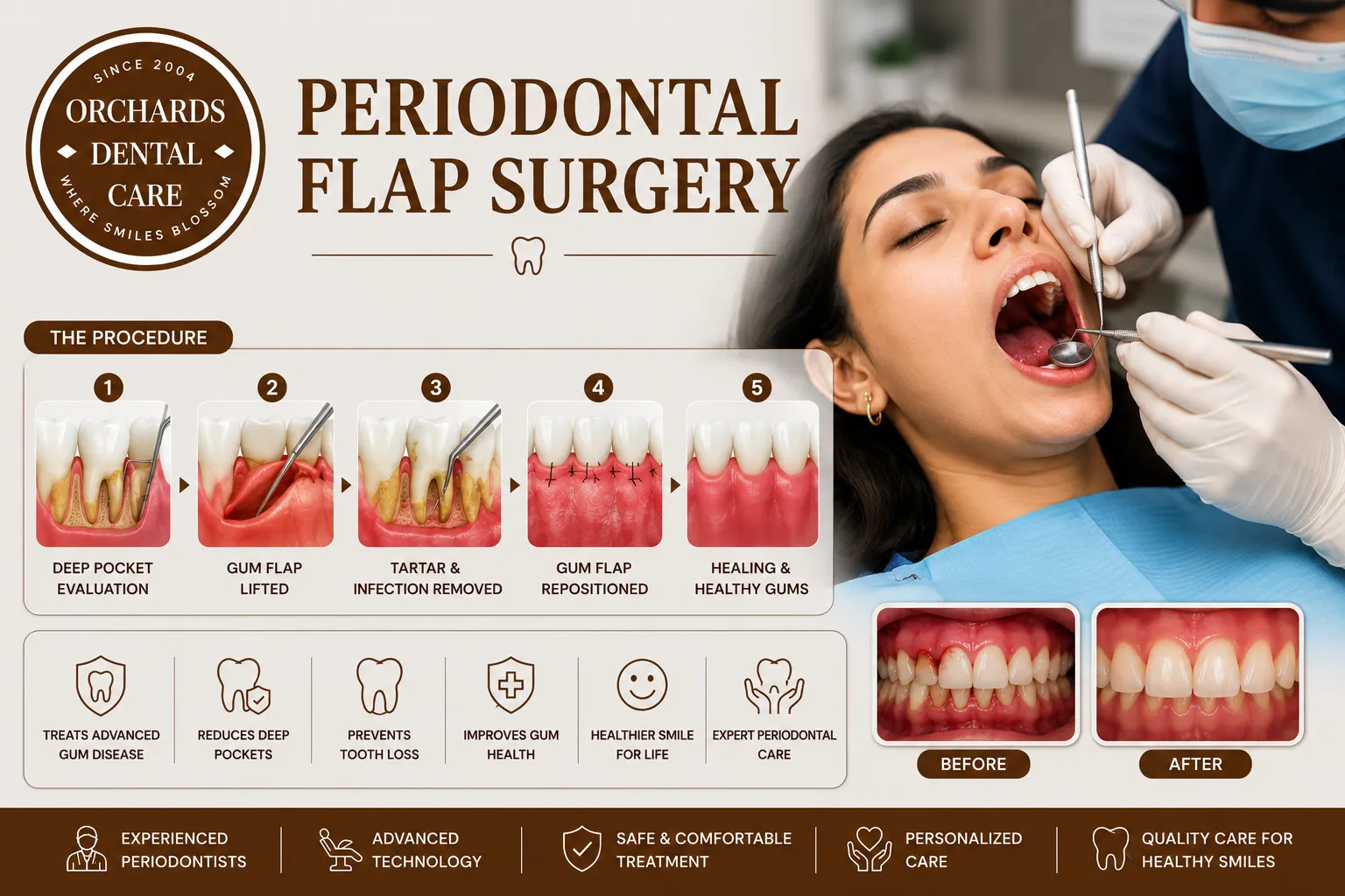 Periodontal Flap Surgery image 1