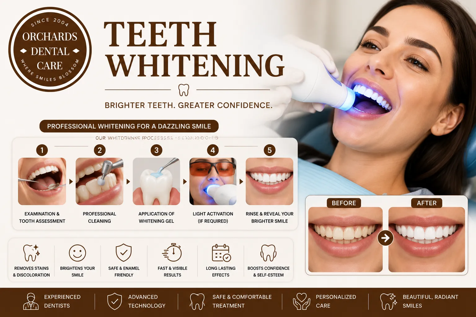 Teeth Whitening image 1