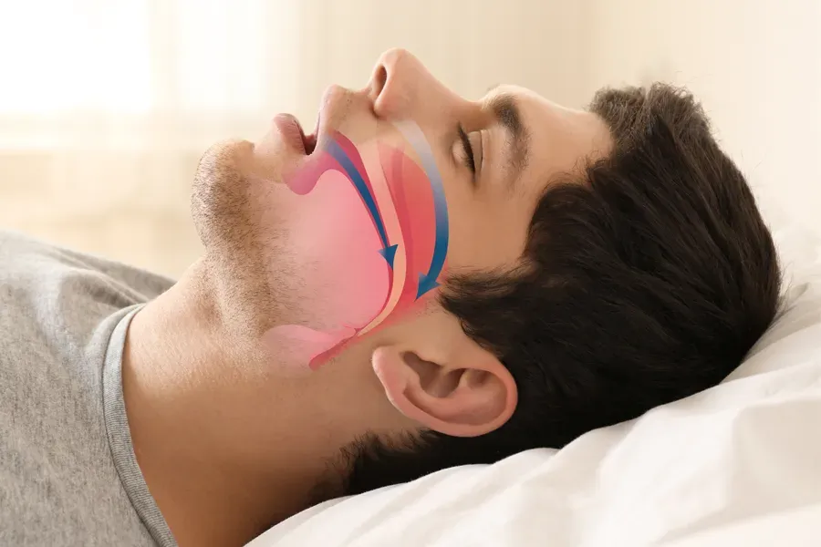 Sleep Apnoea and Snoring Treatment image 1