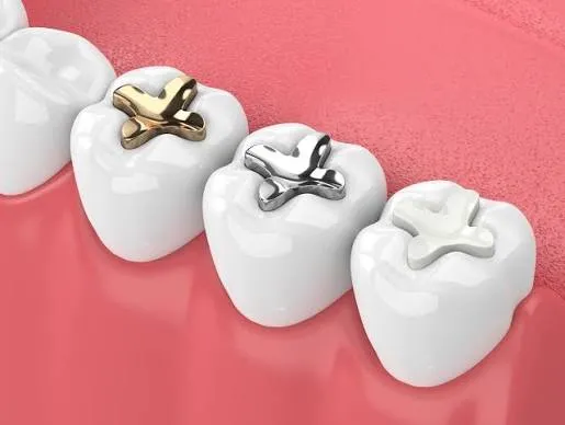 Restoration and Fillings image 1