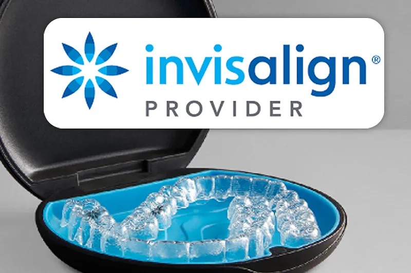Invisalign image 2