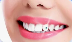 tooth Jewellery image 1