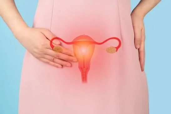 Menstrual Disorders Management image 1