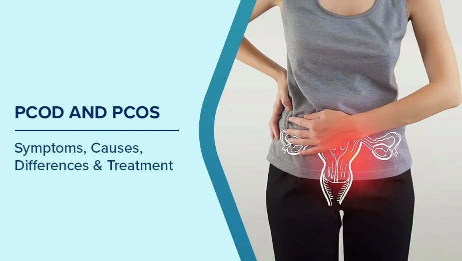 PCOS Treatment image 1
