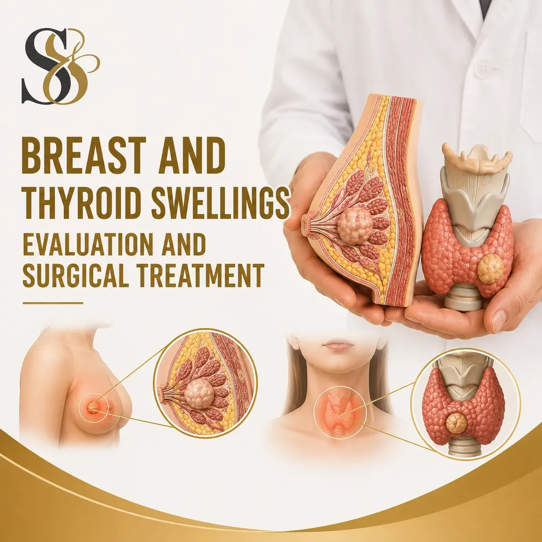 Breast and Thyroid Swellings Evaluation and Surgical Treatment image 1