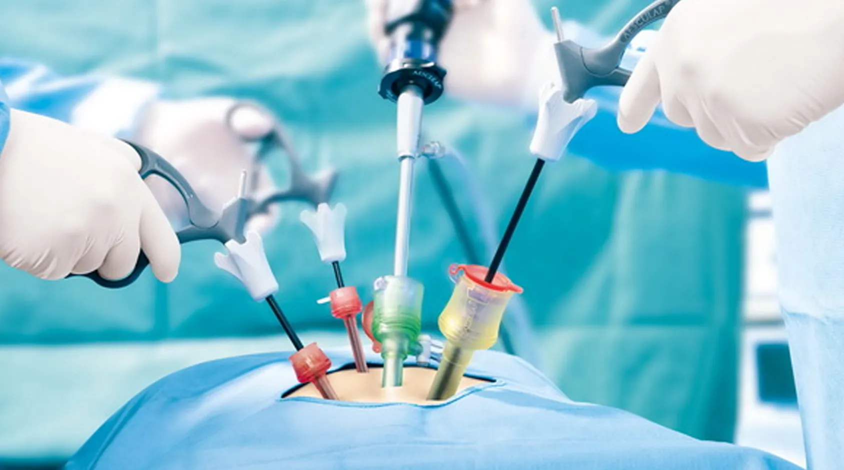 Diagnostic and Operative Hysteroscopy image 1