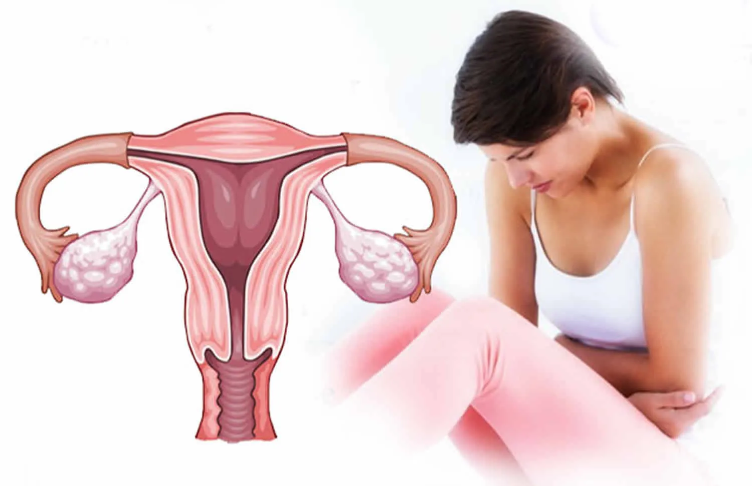 Irregular Periods and Abnormal Uterine Bleeding image 1