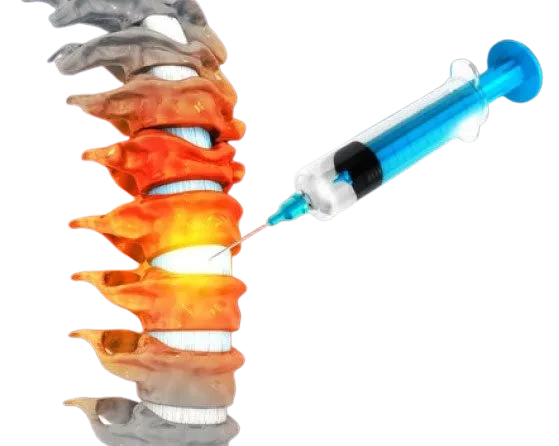 Spine Injection image 1