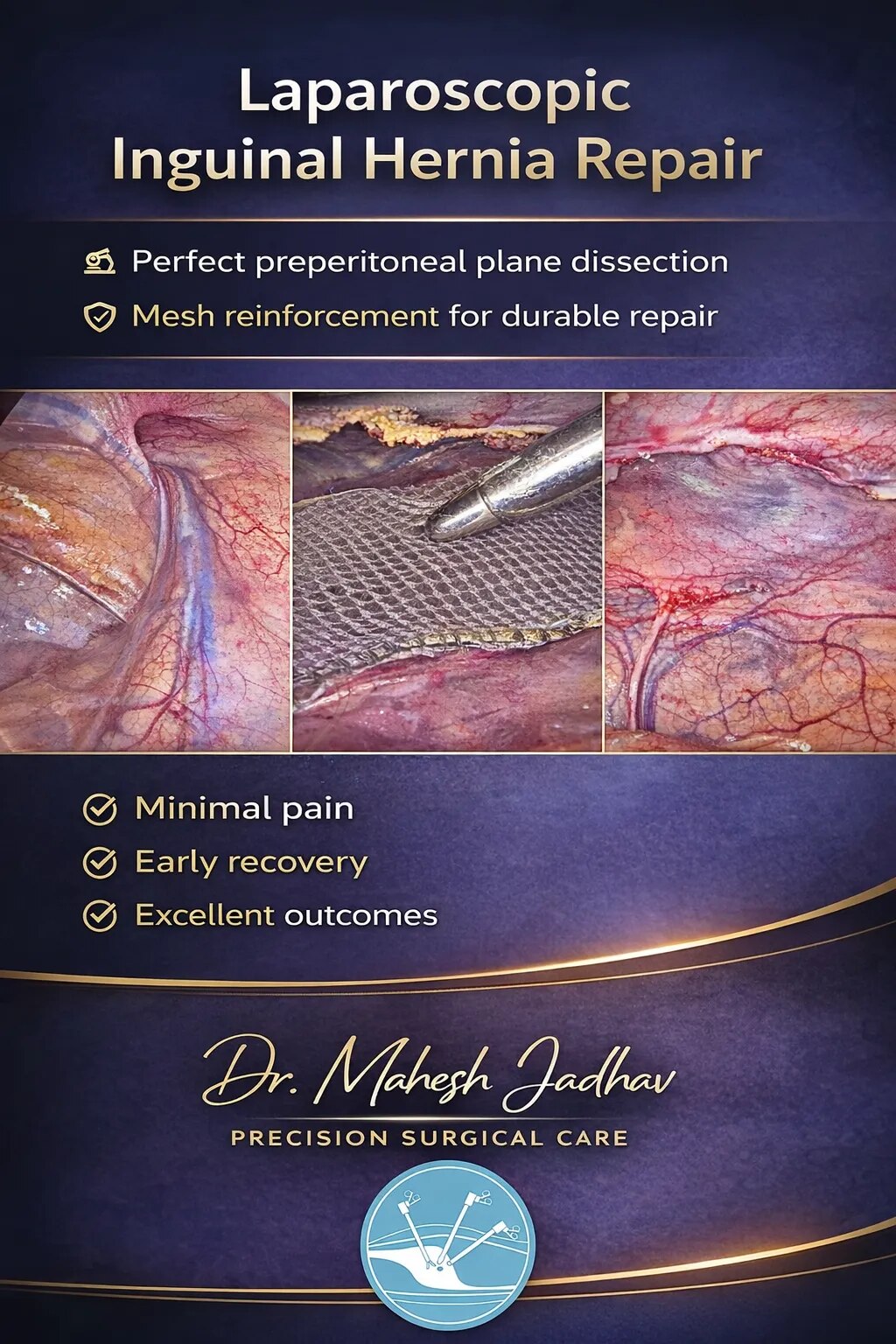 Laparoscopic Hernia Repair image 1