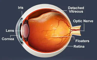 Flashes & Floaters image 1