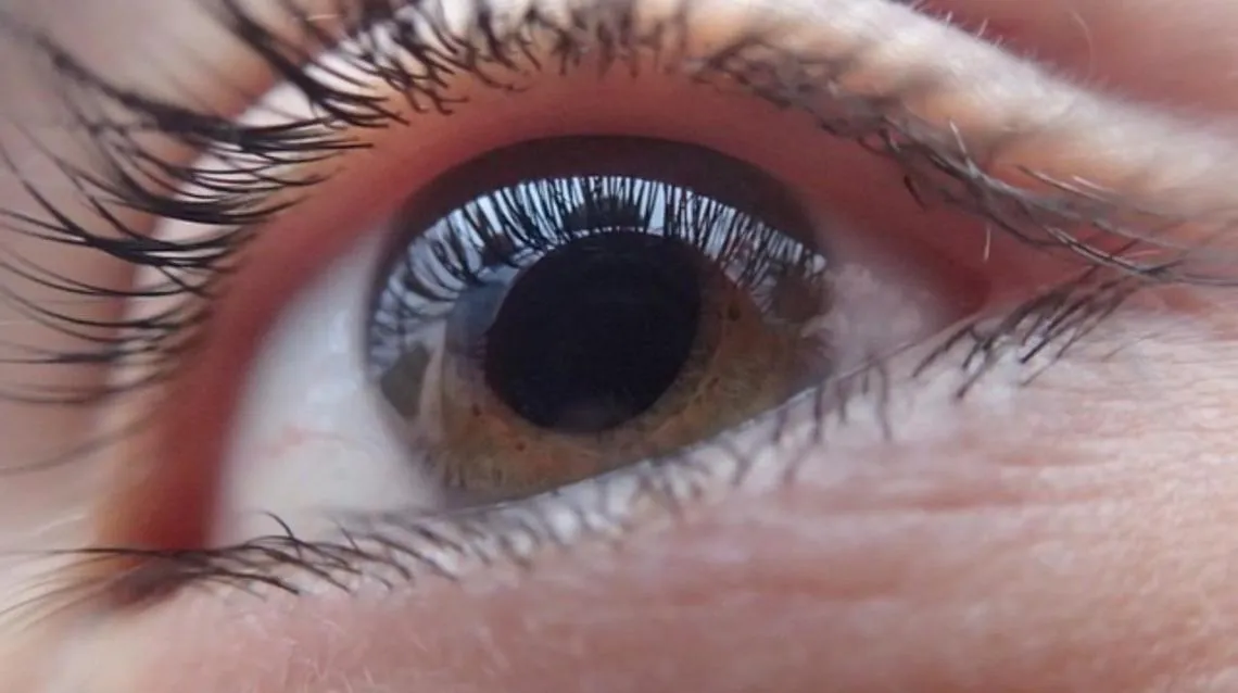 Cataract Surgery image 1