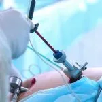 Laparoscopy and Hysteroscopy  in dhanori  image 1