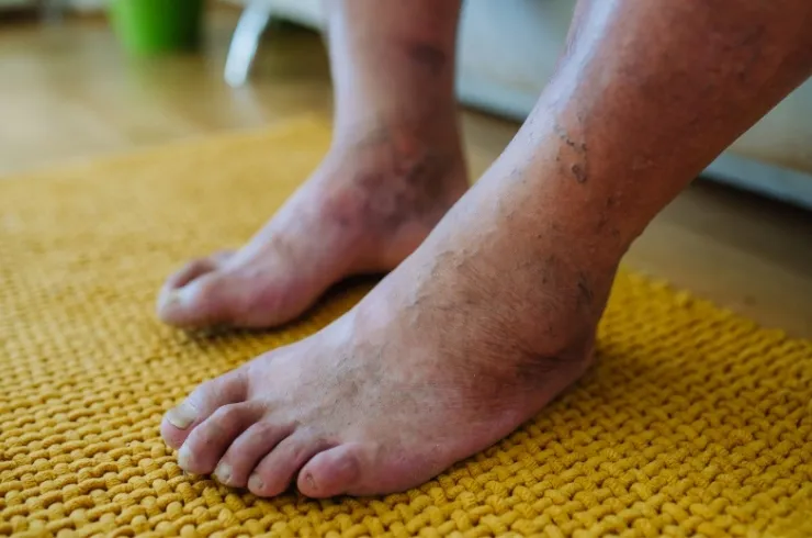 Diabetic Foot Care image 1
