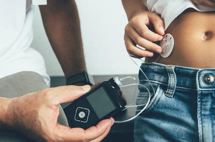 Insulin Pump Therapy image 1