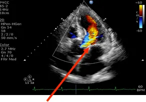 2D Echocardiography & Colour Doppler (Echo) image 1