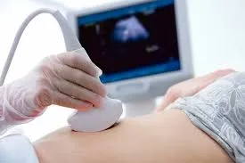 Sonography image 1