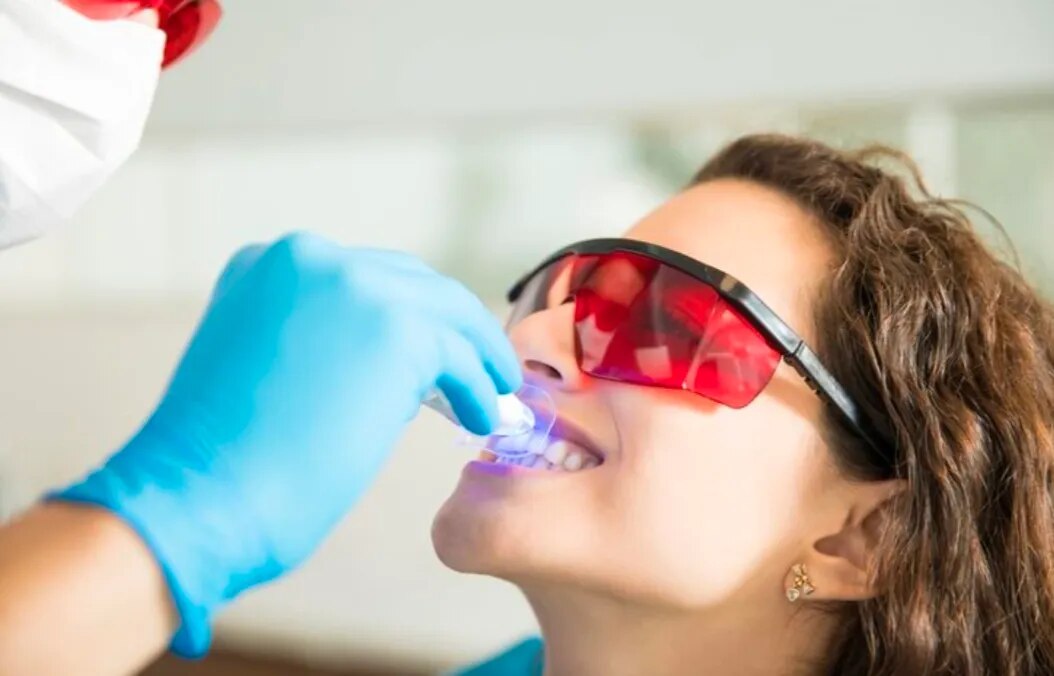 Dental Cleaning & Polishing image 1