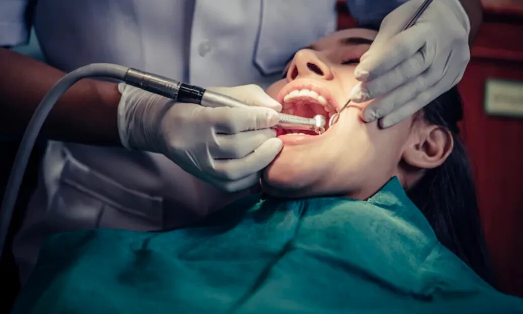 Tooth-Coloured Fillings image 1