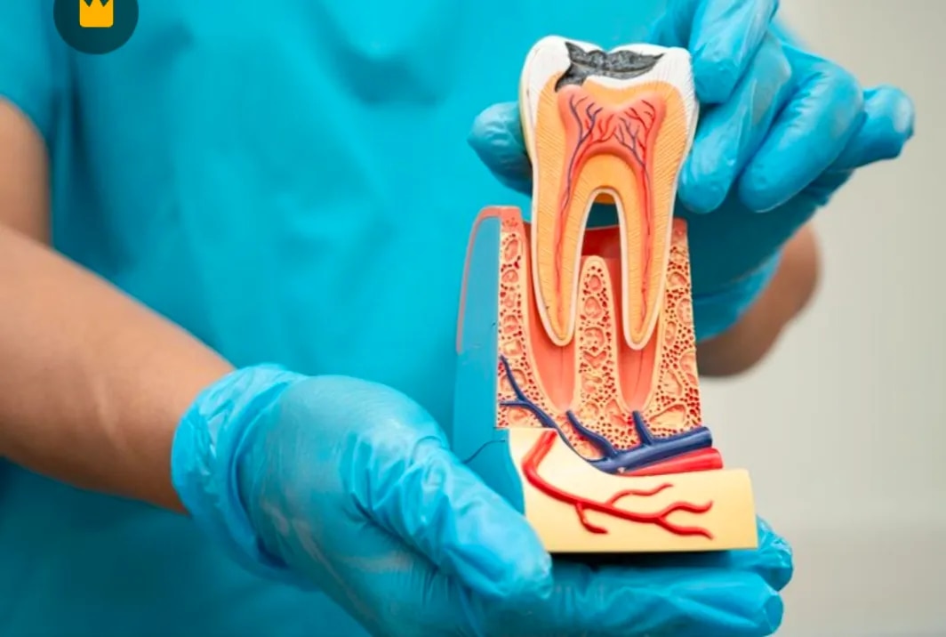 Root Canal Treatment  image 1