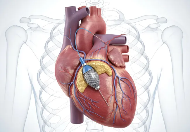 Coronary Angiography image 1