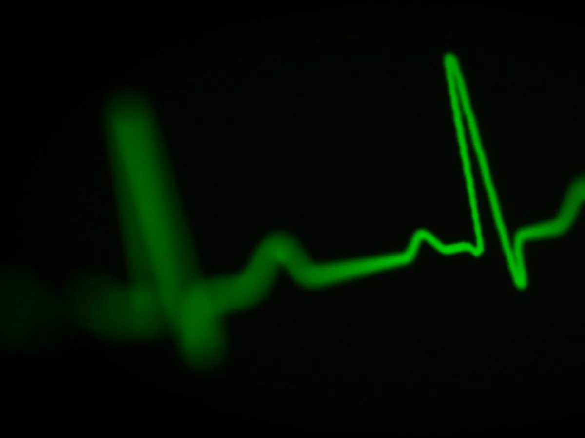 Arrhythmia Ablation image 1