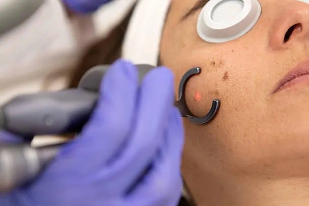 Spot Removal image 1