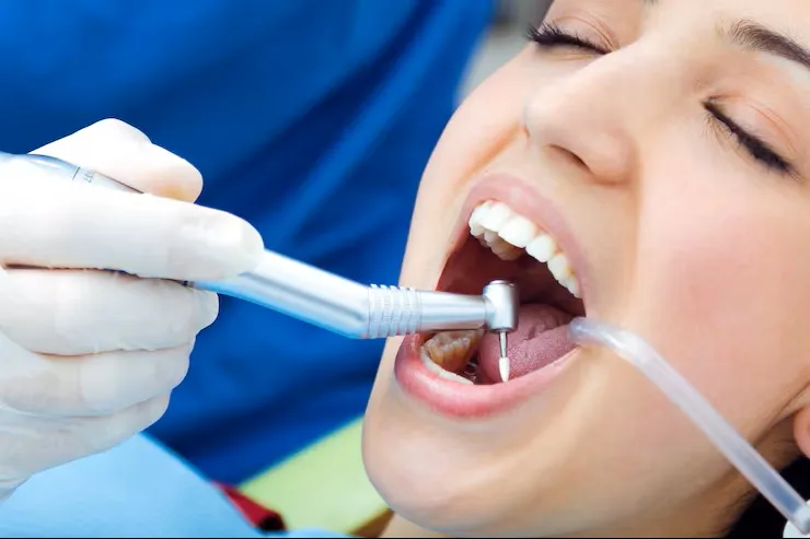 Root Canal Treatment (RCT) image 1