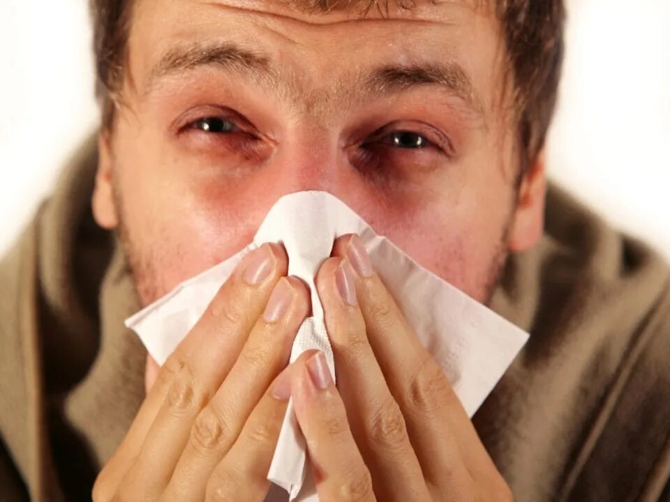 Allergic Rhinitis image 1