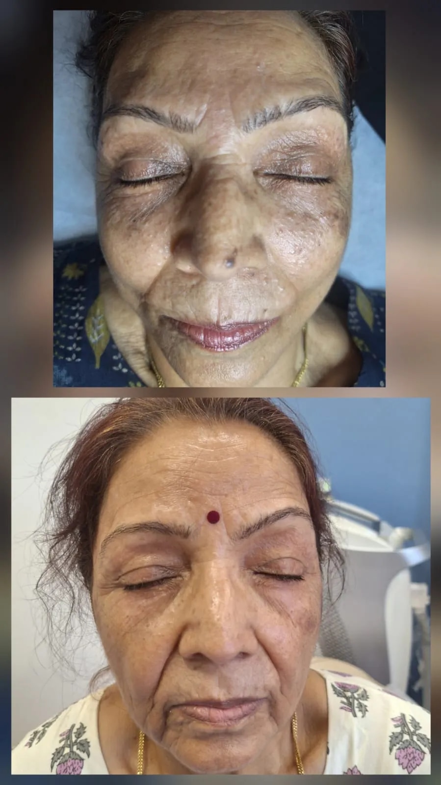 Combination Of Multiple Treatment  image 1