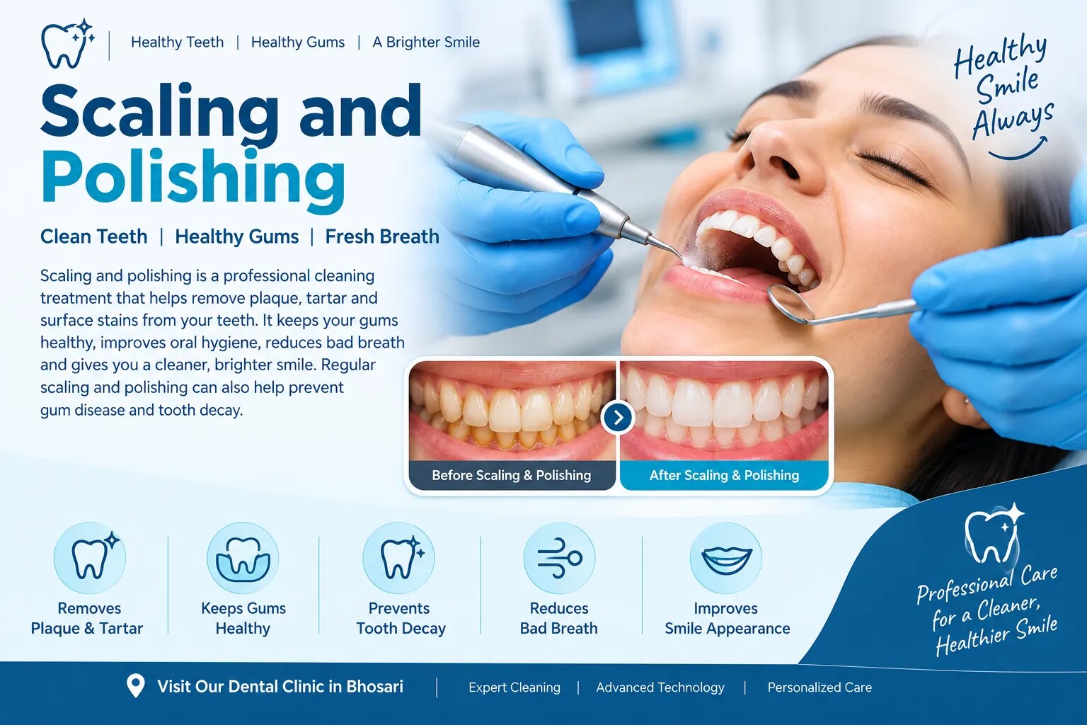 Dental scaling and polishing image 1