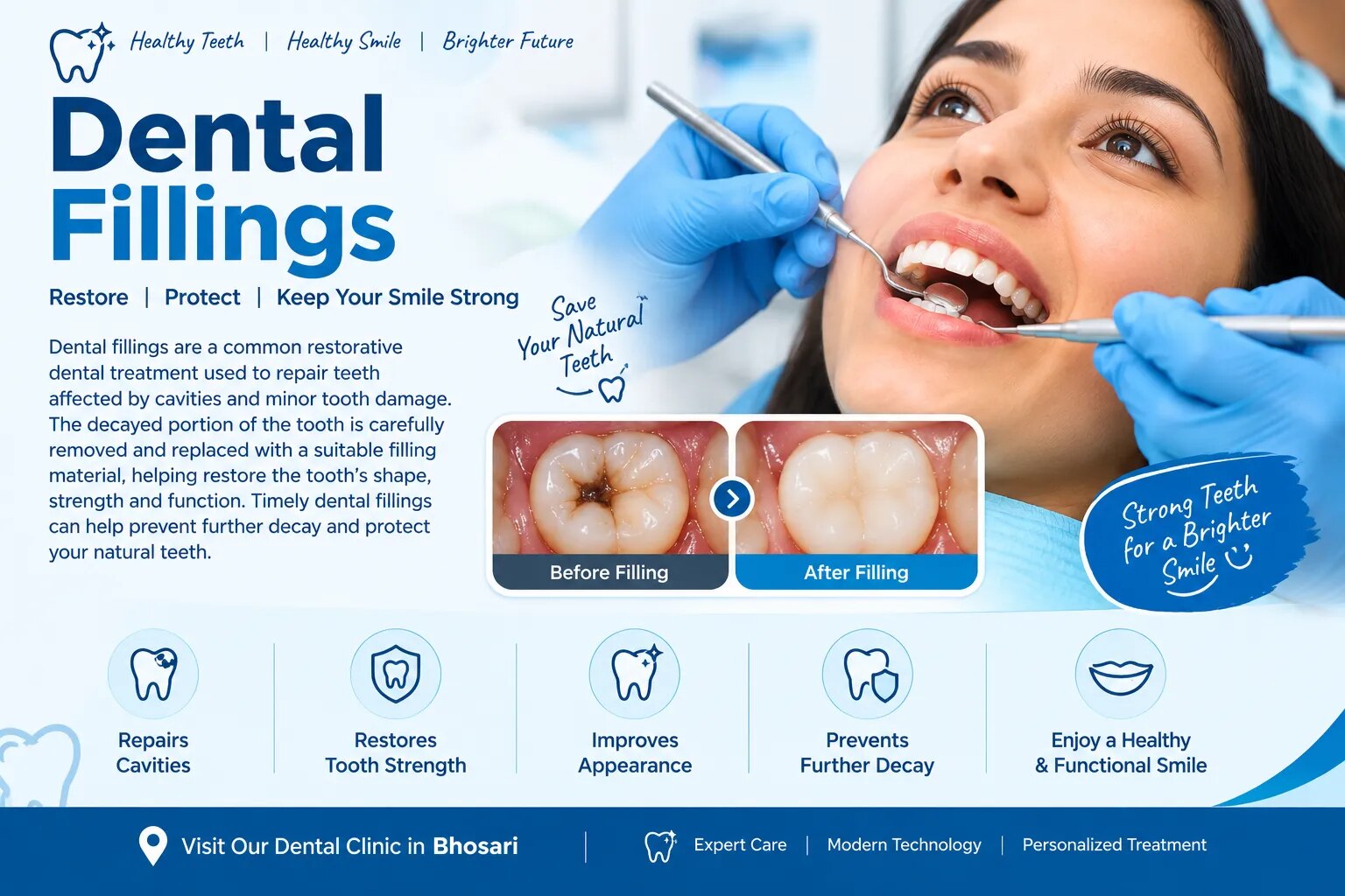Dental Fillings
 image 1