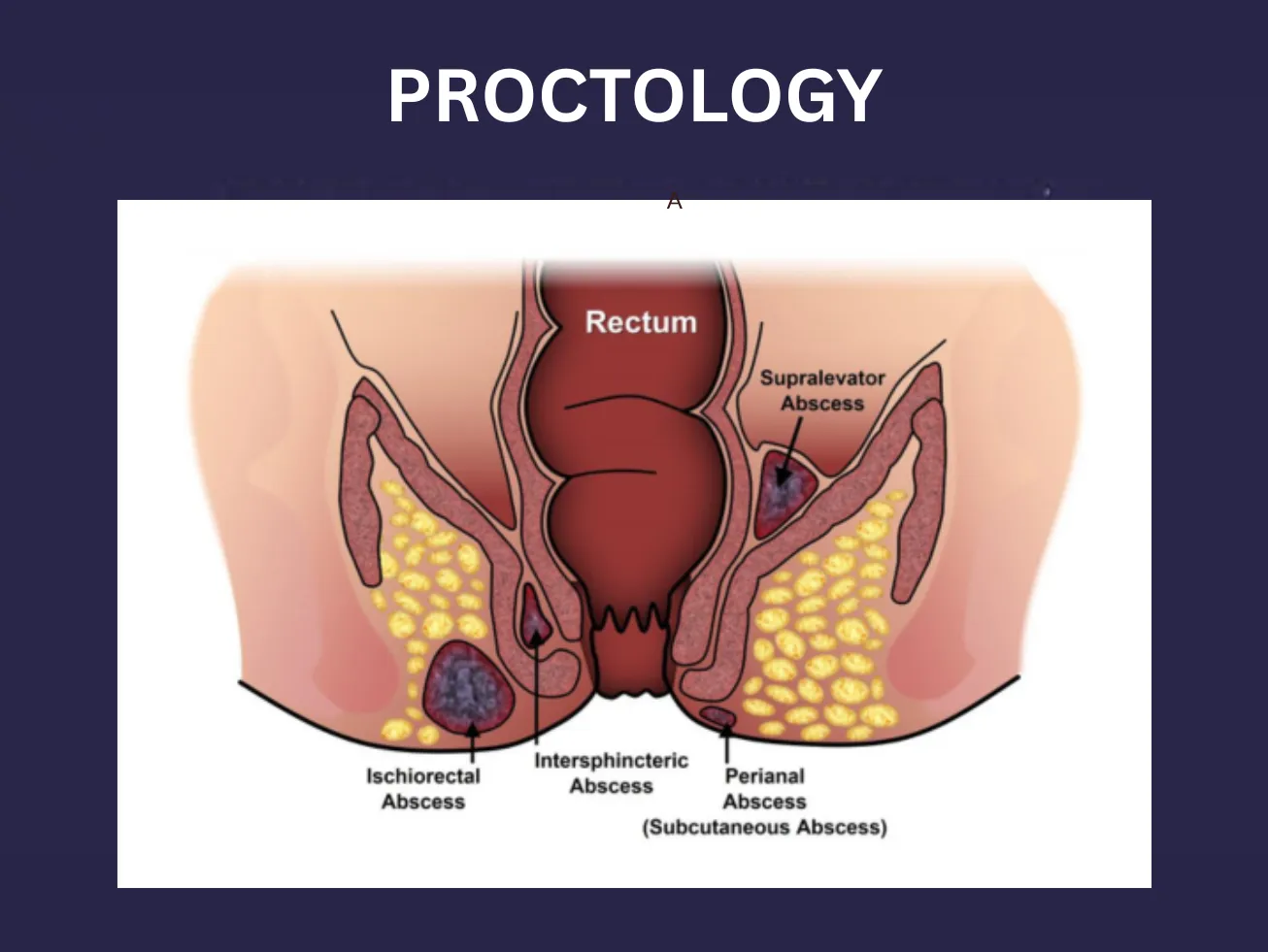 PROCTOLOGY image 1