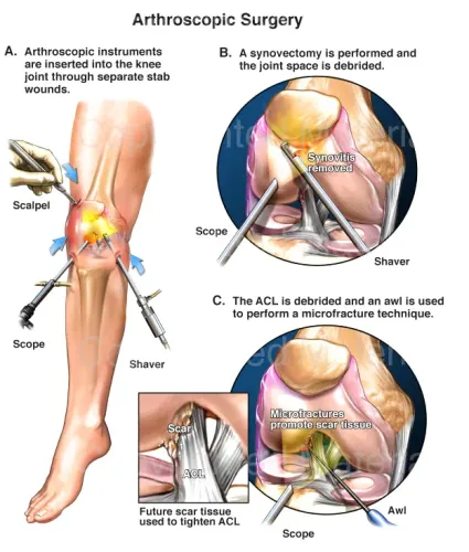 Arthroscopy service image