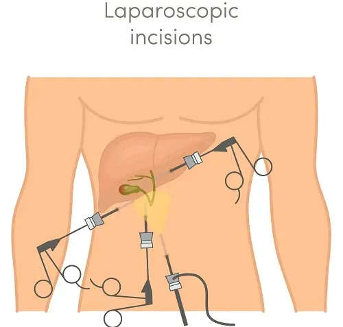 General & Laproscopic Surgery product image