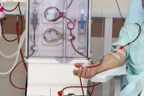 Haemodialysis Regular service image