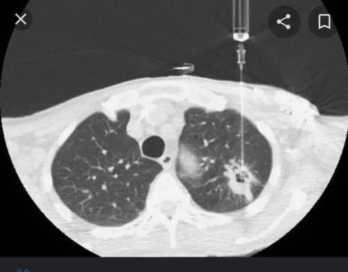 Interventional Radiology  product image