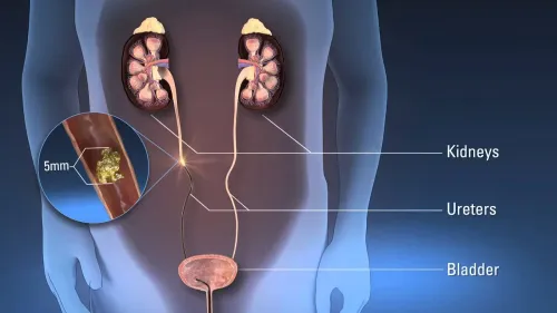 URS Ureteroscopy service image