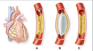 Angiography Surgery service image