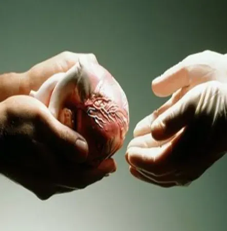 Heart Transplant Surgery service image