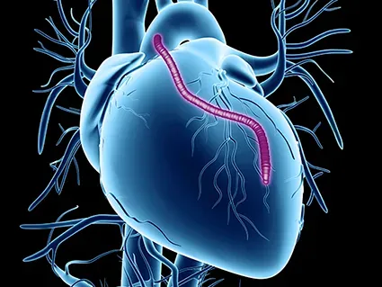 Cardiac/Bypass Surgeon in PCMC,Pune service image