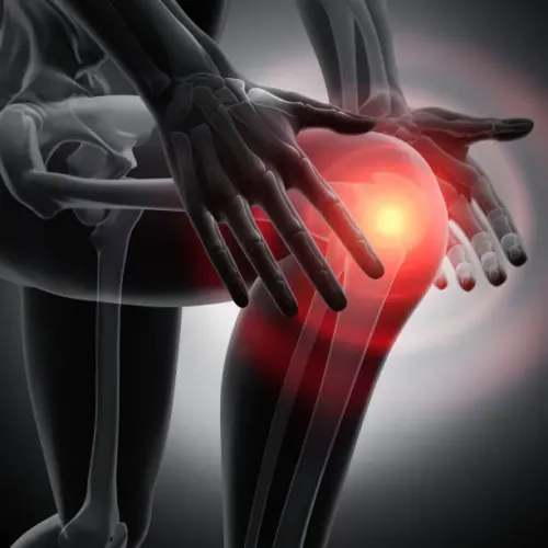 Total Knee Replacement service image