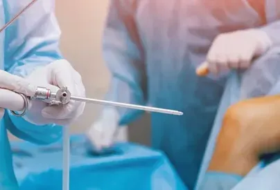 Arthroscopy Surgery service image
