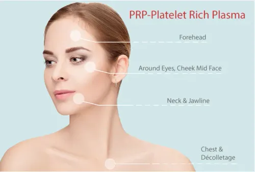 VAMPIRE FACELIFT service image