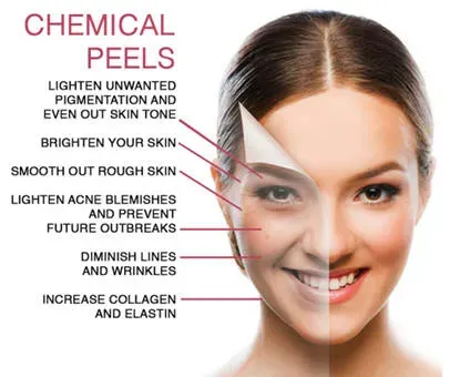 ADVANCED CHEMICAL PEELS service image