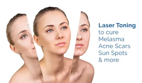 LASER SKIN TONING service image