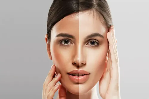 SKIN LIGHTENING | SKIN WHITENING service image