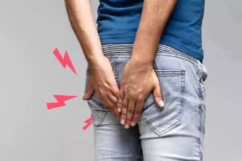 Piles Treatment service image