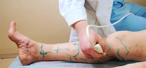 Vascular surgery service image