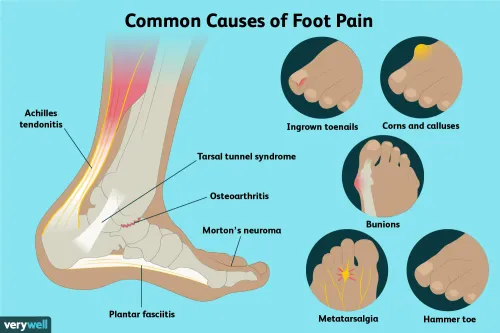 FOOT AND ANKLE PAIN service image