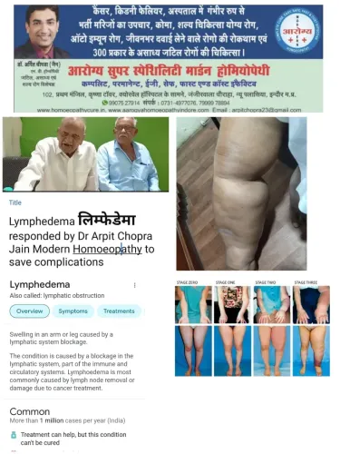 Lymphedema Treatment  लिम्फेडेमा service image